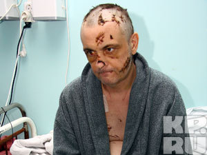 Бизнесмен Сергей Тимин чудом выжил после 126 ударов топором.